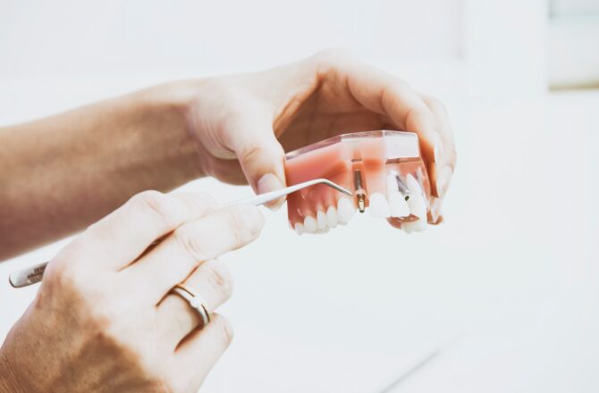 The Advantages Of Biological Dentistry